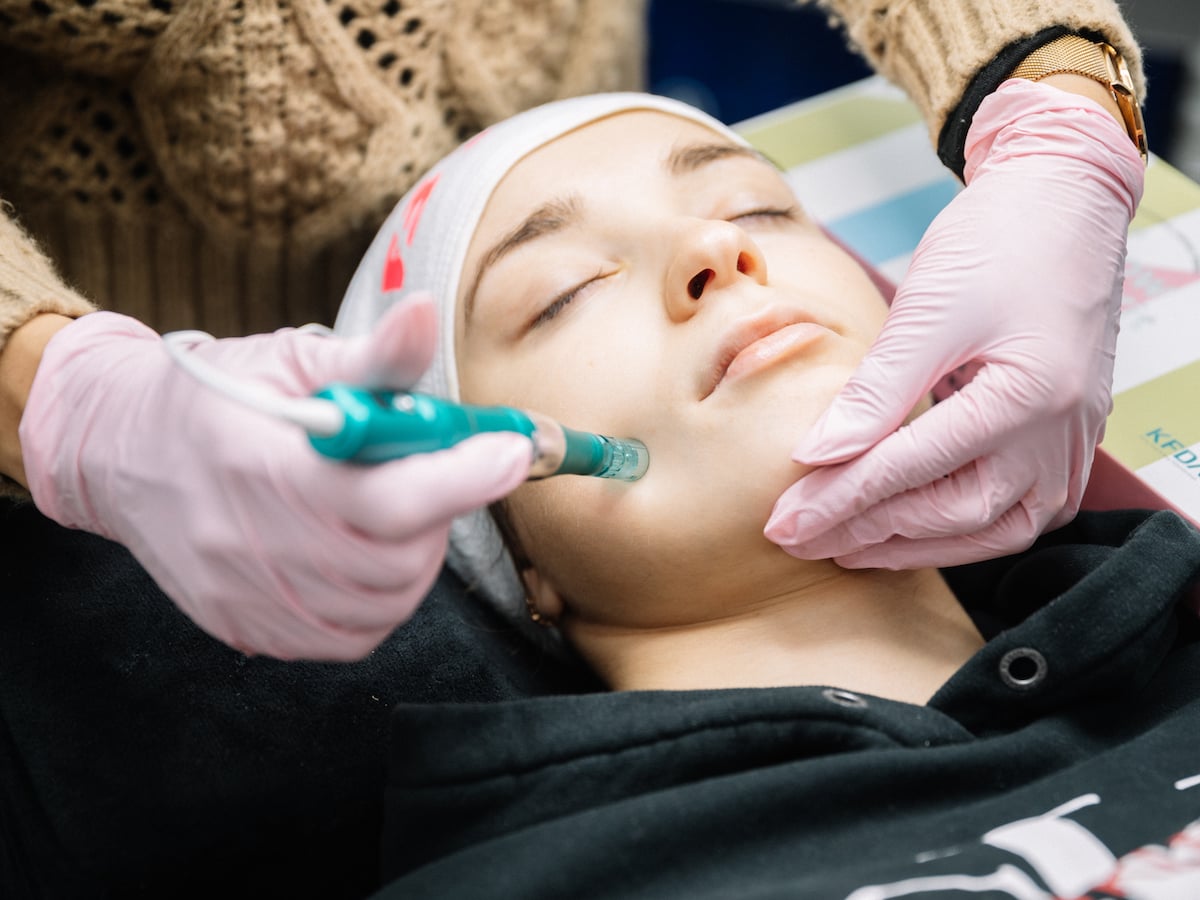 Schulung zu Micro Needling bei Fatima Beauty in Berlin